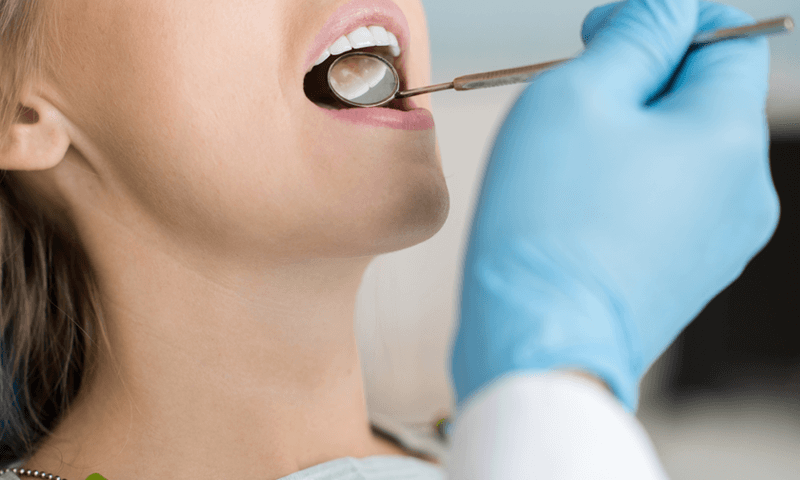 descubre-los-beneficios-de-una-limpieza-dental-–dental-alvarez