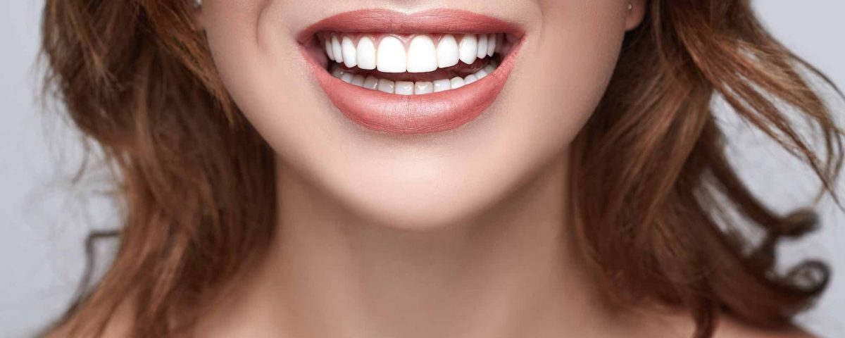Dental Alvarez - 7 Makeovers dentales de celebridades