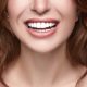 Dental Alvarez - 7 Makeovers dentales de celebridades