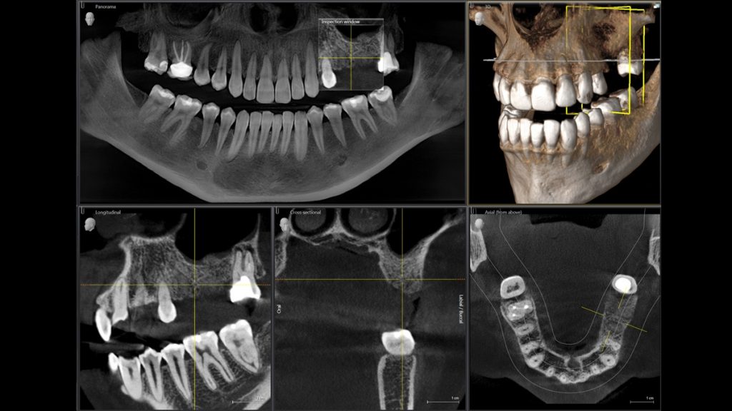 Tecnología 3D - Dental Alvarez