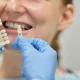 cuantos-tipos-de-mini-implantes-para-ortodoncia-existen-dental-alvarez-tijuana