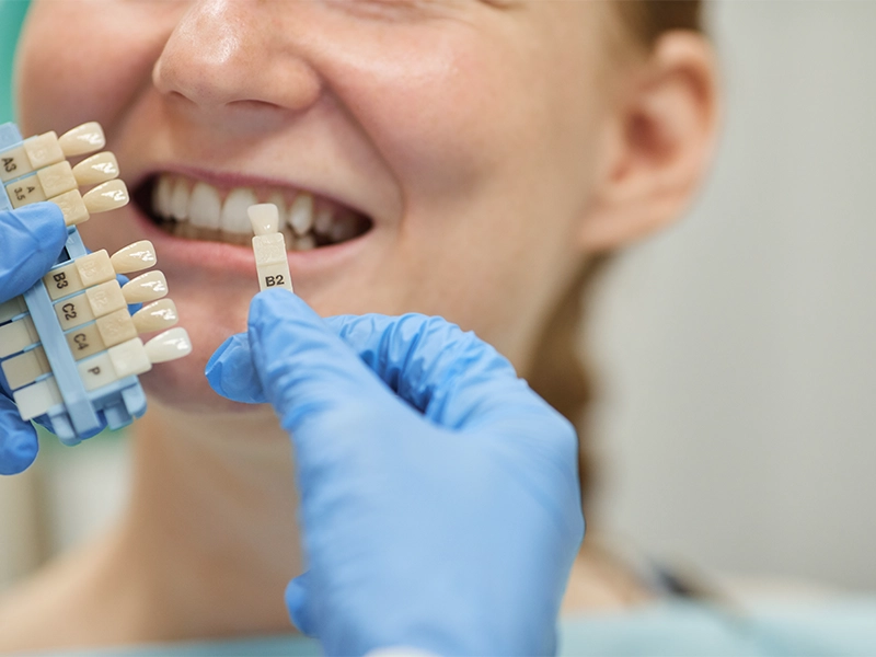 cuantos-tipos-de-mini-implantes-para-ortodoncia-existen-dental-alvarez-tijuana