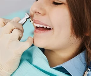 la-placa-dental-es-una-acumulacion-de-bacteria-que-con-el-paso-del-tiempo-se-endurece-dental-alvarez